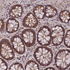 Immunohistochemical staining of human rectum shows strong cytoplasmic positivity in glandular cells.