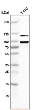 Anti-PGR Antibody