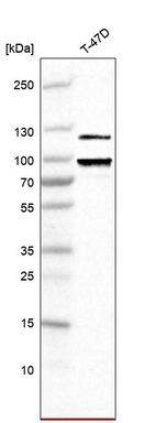 Western blot analysis in human cell line TD47D.