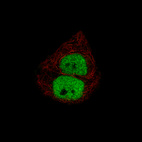 Anti-PGR Antibody