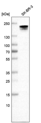 Anti-ERBB2 Antibody