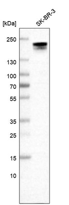 Anti-ERBB2 Antibody