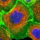 Immunofluorescent staining of human cell line A-431 shows localization to plasma membrane.