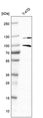Western blot analysis in human cell line TD47D.