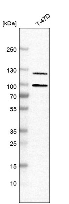 Anti-PGR Antibody