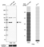 Anti-TP53 Antibody