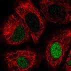 Immunofluorescent staining of human cell line A549 shows localization to nucleoplasm.