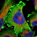 Immunofluorescent staining of human cell line U-251 MG shows localization to plasma membrane & cytosol.