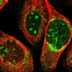 Immunofluorescent staining of human cell line A-431 shows positivity in nucleoli & cytoplasm.