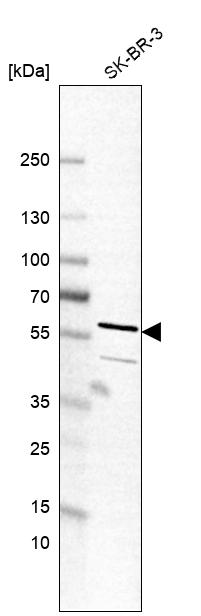 Anti-TC2N Antibody