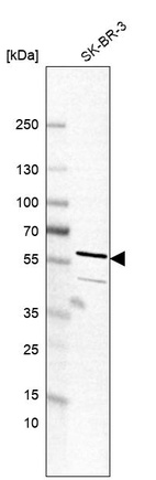 Anti-TC2N Antibody