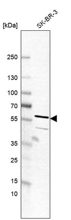 Anti-TC2N Antibody
