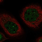 Immunofluorescent staining of human cell line A-431 shows localization to nucleoplasm & nuclear bodies.