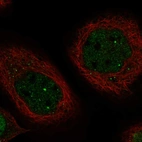 Immunofluorescent staining of human cell line A-431 shows localization to nucleoplasm & nuclear bodies.