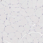 Immunohistochemical staining of human skeletal muscle shows no positivity in myocytes as expected.