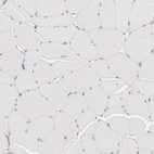 Immunohistochemical staining of human skeletal muscle shows no positivity in myocytes as expected.