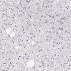 Immunohistochemical staining of human liver shows no positivity in hepatocytes as expected.