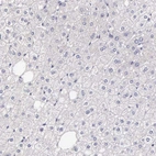 Immunohistochemical staining of human liver shows no positivity in hepatocytes as expected.
