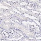 Immunohistochemical staining of human kidney shows no positivity in cells in tubules as expected.