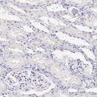 Anti-HMGXB4 Antibody