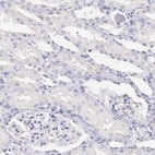 Immunohistochemical staining of human kidney shows no positivity in cells in tubules as expected.
