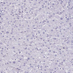 Immunohistochemical staining of human liver shows no positivity in hepatocytes as expected.