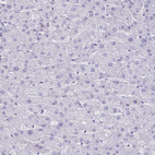 Anti-NPY Antibody