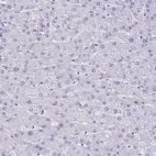 Immunohistochemical staining of human liver shows no positivity in hepatocytes as expected.