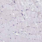 Immunohistochemical staining of human skeletal muscle shows no positivity in myocytes as expected.