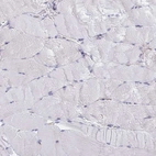 Immunohistochemical staining of human skeletal muscle shows no positivity in myocytes as expected.
