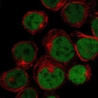 Anti-HOXB9 Antibody
