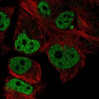 Anti-NUPR1 Antibody