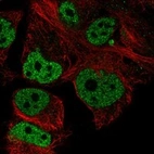 Anti-NUPR1 Antibody