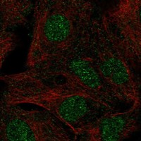 Anti-TBX18 Antibody