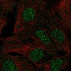 Anti-TBX18 Antibody