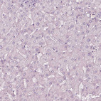 Immunohistochemical staining of human liver shows no positivity in hepatocytes as expected.