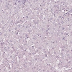 Immunohistochemical staining of human liver shows no positivity in hepatocytes as expected.