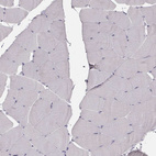 Immunohistochemical staining of human skeletal muscle shows no positivity in myocytes as expected.
