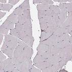 Immunohistochemical staining of human skeletal muscle shows no positivity in myocytes as expected.
