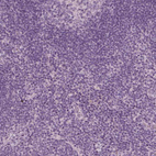 Immunohistochemical staining of human lymph node shows no positivity in non-germinal center cells as expected.