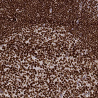 Anti-PARP1 Antibody