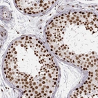 Immunohistochemical staining of human testis shows strong nuclear positivity in cells in seminiferous ducts.