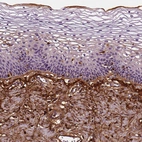 Immunohistochemical staining of human uterine cervix shows strong positivity in the extracellular matrix.