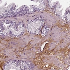 Immunohistochemical staining of human prostate shows moderate positivity in the extracellular matrix.