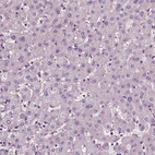 Immunohistochemical staining of human liver shows no positivity as expected.