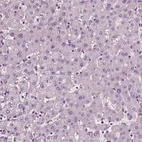 Immunohistochemical staining of human liver shows no positivity as expected.