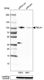 Western blot analysis in RT-4 cells transfected with control siRNA, target specific siRNA probe #1, using Anti-FBLN1 antibody. Remaining relative intensity is presented. Loading control: Anti-GAPDH.