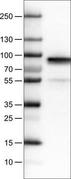 Lane 1: Marker [kDa]_br/_Lane 2: Human plasma