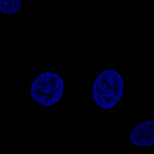 Immunofluorescence staining of MCF7 cells using the Anti-FBLN1 monoclonal antibody, showing no specific staining of vesicles. MCF7 cells serves as a negative control based on RNA-seq values. Microtubule- and nuclear probes are visualized in red and blue, respectively (where available).