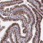 Anti-PARP1 Antibody